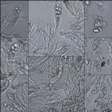 Lecidella elaeochroma f. elaeochroma image