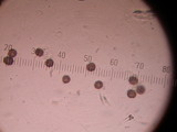 Scleroderma areolatum image