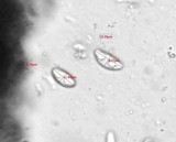 Candelariella citrina image