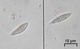 Anisomeridium polypori image