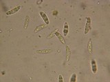 Ascocoryne cylichnium image