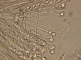 Ascocoryne cylichnium image