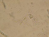 Ascocoryne cylichnium image