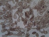Coprinellus radians image