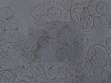 Coprinellus radians image