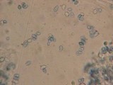 Rhodocybe hirneola image