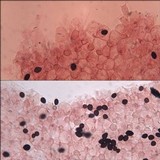 Coprinellus marculentus image