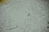 Calonectria pyrochroa image