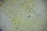 Calycellina populina image