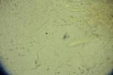 Calycellina populina image