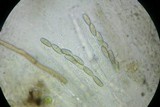 Helminthosphaeria corticiorum image