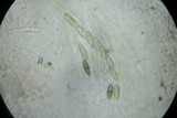 Helminthosphaeria corticiorum image