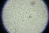 Phomatospora berkeleyi image