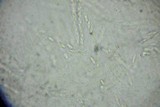 Phomatospora berkeleyi image
