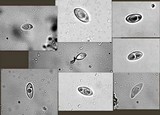 Candelariella citrina image