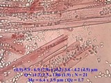 Phycomyces blakesleeanus image