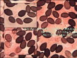 Coprinellus marculentus image