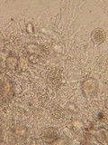 Sebacina epigaea image