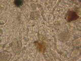 Sebacina epigaea image