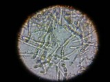 Dacrymyces stillatus image