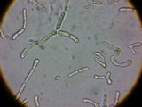 Dacrymyces stillatus image