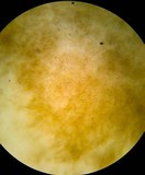 Ditiola peziziformis image
