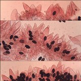 Psathyrella bipellis image
