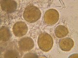 Endogone pisiformis image