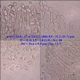 Peziza vesiculosa image