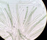 Hypocrea strictipilosa image