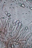 Pseudocraterellus calyculus image