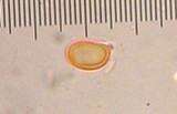 Hygrocybe acutoconica image