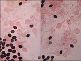 Coprinopsis pseudonivea image