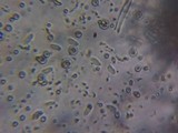 Byssomerulius corium image