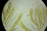 Phaeosphaeria culmorum image