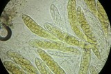 Phaeosphaeria culmorum image
