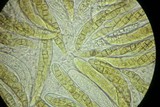 Phaeosphaeria culmorum image
