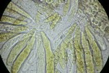 Phaeosphaeria culmorum image