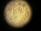 Ascobolus albidus image
