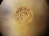 Ascobolus albidus image