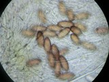 Ascobolus albidus image