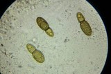 Splanchospora ampullacea image