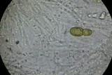 Splanchospora ampullacea image