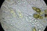 Splanchospora ampullacea image