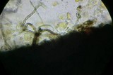 Splanchospora ampullacea image