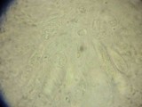 Calosphaeria cryptospora image
