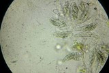 Capronia parasitica image