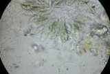 Capronia parasitica image