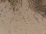 Hypomyces semitranslucens image