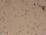 Hypomyces semitranslucens image